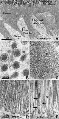 Posttranslational Amelogenin Processing and Changes in Matrix Assembly during Enamel Development